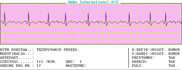 Wykresy EKG - c17-0.png